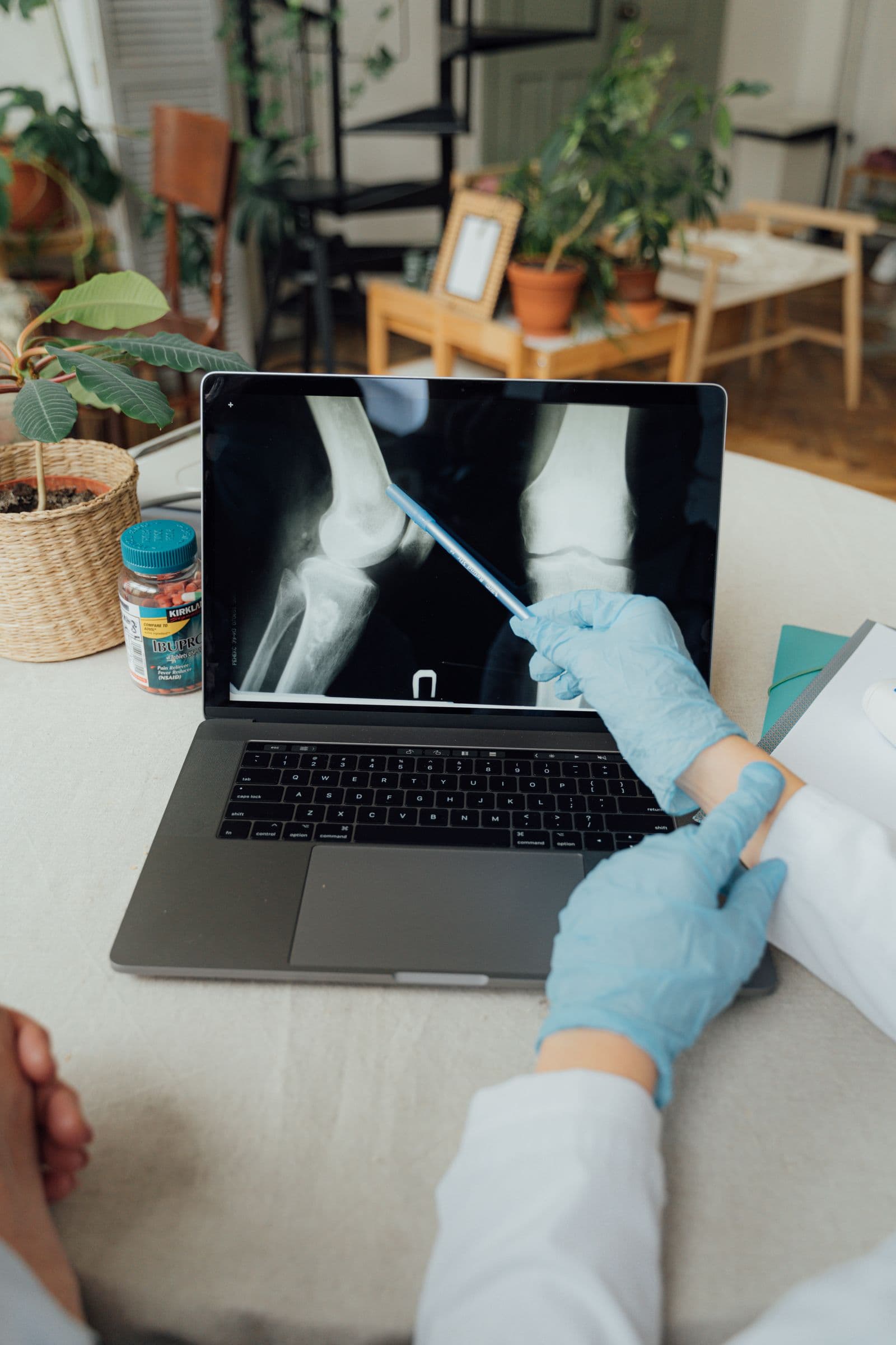Physician reviewing a knee X-ray during a patient consultation